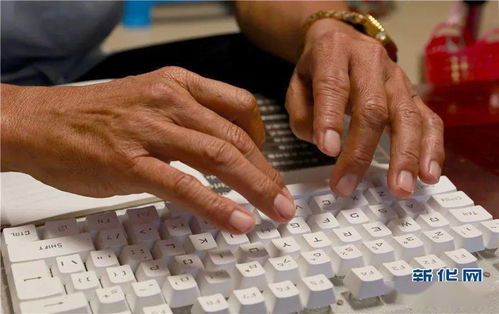 單腿撐起健康夢——記新華網(wǎng)點(diǎn)贊的彌渡縣鄉(xiāng)村醫(yī)生李華